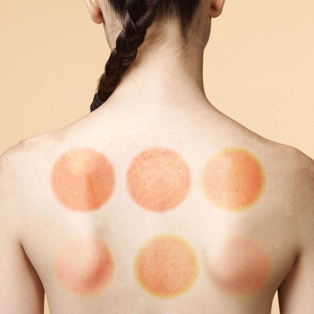 Ensemble de ventouses pour thérapie | CuppingTherapy™